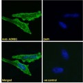 ADRB1 Antibody - ADRB1 antibody immunofluorescence analysis of paraformaldehyde fixed HeLa cells, permeabilized with 0.15% Triton. Primary incubation 1hr (10ug/ml) followed by Alexa Fluor 488 secondary antibody (2ug/ml), showing membrane staining. The nuclear stain is DAPI (blue). Negative control: Unimmunized goat IgG (10ug/ml) followed by Alexa Fluor 488 secondary antibody (2ug/ml).
