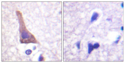 ADRB2 Antibody - Immunohistochemistry analysis of paraffin-embedded human brain, using Adrenergic Receptor beta2 (Phospho-Ser346) Antibody. The picture on the right is blocked with the phospho peptide.