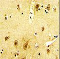 ADRB2 Antibody - Formalin-fixed and paraffin-embedded human brain reacted with ADRB2 Antibody (S364), which was peroxidase-conjugated to the secondary antibody, followed by DAB staining. This data demonstrates the use of this antibody for immunohistochemistry; clinical relevance has not been evaluated.