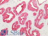 ADRB3 Antibody - Human Prostate: Formalin-Fixed, Paraffin-Embedded (FFPE)