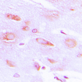 ADRBK1 / GRK2 Antibody - Immunohistochemical analysis of GRK2 (pS29) staining in human brain formalin fixed paraffin embedded tissue section. The section was pre-treated using heat mediated antigen retrieval with sodium citrate buffer (pH 6.0). The section was then incubated with the antibody at room temperature and detected using an HRP conjugated compact polymer system. DAB was used as the chromogen. The section was then counterstained with hematoxylin and mounted with DPX.