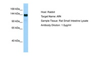 AF5Q31 / AFF4 Antibody -  This image was taken for the unconjugated form of this product. Other forms have not been tested.