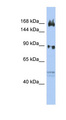 AFF2 / OX19 Antibody - AFF2 antibody Western blot of OVCAR-3 cell lysate. This image was taken for the unconjugated form of this product. Other forms have not been tested.