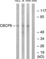 AGBL4 Antibody - Western blot analysis of lysates from A549, HeLa, and Jurkat cells, using AGBL4 Antibody. The lane on the right is blocked with the synthesized peptide.