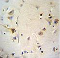 AGBL5 Antibody - AGBL5 Antibody immunohistochemistry of formalin-fixed and paraffin-embedded human brain tissue followed by peroxidase-conjugated secondary antibody and DAB staining.