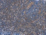 AGFG1 Antibody - Immunohistochemistry of paraffin-embedded Human tonsil using AGFG1 Polyclonal Antibody at dilution of 1:60.