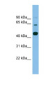 AGMO / TMEM195 Antibody - AGMO / TMEM195 antibody Western blot of COLO205 cell lysate. This image was taken for the unconjugated form of this product. Other forms have not been tested.
