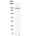 AGO4 / EIF2C4 Antibody - Western blot testing of 1) rat thymus and 2) human 22RV1 lysate with AGO4 antibody at 0.5ug/ml. Predicted molecular weight ~97 kDa, observed here at ~115 kDa.