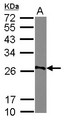 AGPAT1 Antibody - Sample (30 ug of whole cell lysate) A: Raji 12% SDS PAGE AGPAT1 antibody diluted at 1:500