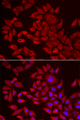 AGPAT2 Antibody - Immunofluorescence analysis of HeLa cells.