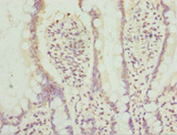 AGPAT2 Antibody - Immunohistochemistry of paraffin-embedded human small intestine tissue at dilution 1:100