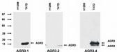 AGR2/AGR3 Antibody - AGR2/AGR3 Antibody in Western Blot (WB)