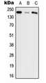 AGRN / Agrin Antibody - Western blot analysis of Agrin expression in HEK293T (A); NIH3T3 (B); PC12 (C) whole cell lysates.