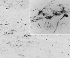 AGRP Antibody - Goat Anti-AGRP / Agouti-related protein Antibody (0.05µg/ml) staining of PFA-perfused cryosection of Human Hypothalamus. Antigen retrieval with citrate buffer pH 6 at 80C for 30min, HRP-staining with Ni-DAB after Biotin-SP-antigoat amplification. Data obtained by Prof. Erik Hrabovszky, Inst, Exp, Med., Budapest, Hungary.