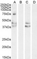 AGTR1 / AT1 Receptor Antibody - Goat Anti-AGTR1 / AT1 Antibody (0.2µg/ml) staining o fHuman Liver (A) + peptide (B), Mouse Liver (C) + peptide (D) lysate (35µg protein in RIPA buffer). Detected by chemiluminescencence.