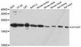 AGTRAP / ATRAP Antibody - Western blot analysis of extracts of various cell lines, using AGTRAP antibody at 1:3000 dilution. The secondary antibody used was an HRP Goat Anti-Rabbit IgG (H+L) at 1:10000 dilution. Lysates were loaded 25ug per lane and 3% nonfat dry milk in TBST was used for blocking. An ECL Kit was used for detection and the exposure time was 10s.