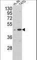 AHSA1 / AHA1 Antibody - Western blot of AHSA1 Antibody in HL-60, T47D cell line lysates (35 ug/lane). AHSA1 (arrow) was detected using the purified antibody.