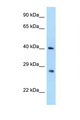 AIDA Antibody - AIDA antibody Western blot of 293T Cell lysate. Antibody concentration 1 ug/ml.  This image was taken for the unconjugated form of this product. Other forms have not been tested.