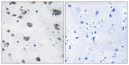 AIFM3 Antibody - Immunohistochemistry analysis of paraffin-embedded human brain, using AIFM3 Antibody. The picture on the right is blocked with the synthesized peptide.