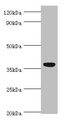 AIM / CD5L Antibody - Western blot All lanes: CD5L antibody at 3µg/ml + A431 whole cell lysate Secondary Goat polyclonal to rabbit IgG at 1/10000 dilution Predicted band size: 38 kDa Observed band size: 38 kDa