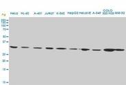 AIM / CD5L Antibody - CD5L monoclonal antibody (M01), clone 1C8. Western Blot analysis of CD5L expression in HL-60.