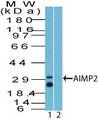 AIMP2 Antibody - Western Blot: AIMP2 Antibody - Analysis of AIMP2 using AIMP2 antibody. Human spleen tissue lysate in the 1) absence and 2) presence of immunizing peptide probed with 2 ug/ml of AIMP2 antibody. Goat anti-rabbit Ig HRP secondary antibody and PicoTect ECL substrate solution were used for this test.