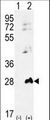 AK1 / Adenylate Kinase 1 Antibody - Western blot of AK1 (arrow) using rabbit polyclonal AK1 Antibody (S45). 293 cell lysates (2 ug/lane) either nontransfected (Lane 1) or transiently transfected (Lane 2) with the AK1 gene.