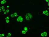 AK1 / Adenylate Kinase 1 Antibody - Immunofluorescent staining of HT29 cells using anti-AK1 mouse monoclonal antibody.