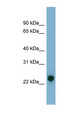 AK3 / Adenylate Kinase 3 Antibody - AK3 antibody Western blot of Fetal liver lysate. This image was taken for the unconjugated form of this product. Other forms have not been tested.
