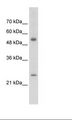 AK4 / Adenylate Kinase 4 Antibody - Jurkat Cell Lysate.  This image was taken for the unconjugated form of this product. Other forms have not been tested.
