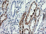 AK4 / Adenylate Kinase 4 Antibody - IHC of paraffin-embedded Human Kidney tissue using anti-AK4 mouse monoclonal antibody. (Heat-induced epitope retrieval by 10mM citric buffer, pH6.0, 100C for 10min).