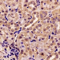 AK4 / Adenylate Kinase 4 Antibody - Immunohistochemical analysis of AK4 staining in rat kidney formalin fixed paraffin embedded tissue section. The section was pre-treated using heat mediated antigen retrieval with sodium citrate buffer (pH 6.0). The section was then incubated with the antibody at room temperature and detected using an HRP conjugated compact polymer system. DAB was used as the chromogen. The section was then counterstained with hematoxylin and mounted with DPX.