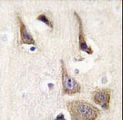 AK5 / Adenylate Kinase 5 Antibody - Formalin-fixed and paraffin-embedded human brain tissue reacted with AK5 Antibody , which was peroxidase-conjugated to the secondary antibody, followed by DAB staining. This data demonstrates the use of this antibody for immunohistochemistry; clinical relevance has not been evaluated.