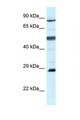 AK7 / Adenylate Kinase 7 Antibody - AK7 antibody Western blot of MCF7 Cell lysate. Antibody concentration 1 ug/ml.  This image was taken for the unconjugated form of this product. Other forms have not been tested.