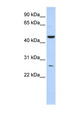 AK9 / AKD1 / AKD2 Antibody - AKD1 / C6orf199 antibody Western blot of Fetal Liver lysate. This image was taken for the unconjugated form of this product. Other forms have not been tested.
