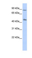 AK9 / AKD1 / AKD2 Antibody - AKD1 / C6orf199 antibody Western blot of HepG2 cell lysate. This image was taken for the unconjugated form of this product. Other forms have not been tested.
