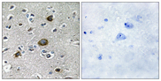 AKAP1 / AKAP Antibody - Immunohistochemistry analysis of paraffin-embedded human brain tissue, using AKAP1 Antibody. The picture on the right is blocked with the synthesized peptide.