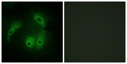 AKAP14 Antibody - Immunofluorescence analysis of HeLa cells, using AKAP14 Antibody. The picture on the right is blocked with the synthesized peptide.
