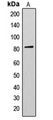 AKAP17A / 721P Antibody - Western blot analysis of AKAP17A expression in Jurkat (A) whole cell lysates.