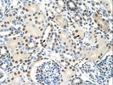 AKAP8L Antibody - AKAP8L antibody ARP39080_T100-NP_055186-AKAP8L (A kinase (PRKA) anchor protein 8-like) Antibody was used in IHC to stain formalin-fixed, paraffin-embedded human kidney.  This image was taken for the unconjugated form of this product. Other forms have not been tested.