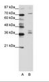 AKAP9 / YOTIAO Antibody - A: Marker, B: Jurkat Cell Lysate.  This image was taken for the unconjugated form of this product. Other forms have not been tested.