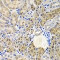 AKR1A1 Antibody - Immunohistochemistry of paraffin-embedded mouse kidney using AKR1A1 antibody at dilution of 1:100 (40x lens).