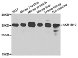 AKR1B10 Antibody - Western blot blot of extracts of various cell lines, using AKR1B10 antibody.