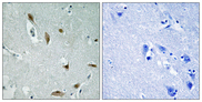 AKT1 + AKT3 Antibody - Immunohistochemistry analysis of paraffin-embedded human brain, using AKT1/3 (Phospho-Tyr437/434) Antibody. The picture on the right is blocked with the phospho peptide.
