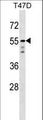 AKT1 Antibody - AKT1 Antibody western blot of T47D cell line lysates (35 ug/lane). The AKT1 antibody detected the AKT1 protein (arrow).
