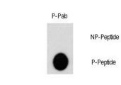 AKT2 Antibody - Dot blot of Phospho-AKT2-S474 polyclonal antibody on nitrocellulose membrane. 50ng of Phospho-peptide or Non Phospho-peptide per dot were adsorbed. Antibody working concentration was 0.5ug per ml. P-antibody: phospho-antibody; P-Peptide: phospho-peptide; NP-Peptide: non-phospho-peptide.