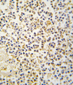 ALDH1A3 Antibody - Formalin-fixed and paraffin-embedded human kidney tissue reacted with ALDH1A3 antibody , which was peroxidase-conjugated to the secondary antibody, followed by DAB staining. This data demonstrates the use of this antibody for immunohistochemistry; clinical relevance has not been evaluated.