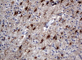 ALDH1L1 Antibody - Immunohistochemical staining of paraffin-embedded human embryonic brain cortex tissue using ALDH1L1 clone UMAB43 mouse monoclonal antibody. Heat-induced epitope retrieval by 10mM citric buffer, pH6.0, 120C for 3min in pressure chamber/cooker.was diluted 1:400 and detection shown with HRP enzyme and DAB chromogen. Strong cytoplasmic and membranous staining is seen in the in the glia, nueronal, and endothelial cells.