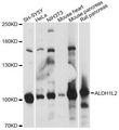 ALDH1L2 Antibody - Western blot analysis of extracts of various cell lines, using ALDH1L2 antibody at 1:1000 dilution. The secondary antibody used was an HRP Goat Anti-Rabbit IgG (H+L) at 1:10000 dilution. Lysates were loaded 25ug per lane and 3% nonfat dry milk in TBST was used for blocking. An ECL Kit was used for detection and the exposure time was 1s.