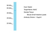 ALDH2 Antibody -  This image was taken for the unconjugated form of this product. Other forms have not been tested.